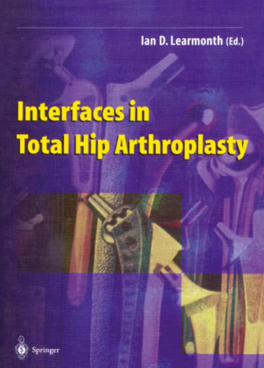 Actual product image Interfaces in Total Hip Arthroplasty (Ian D. Learmonth, 2012)