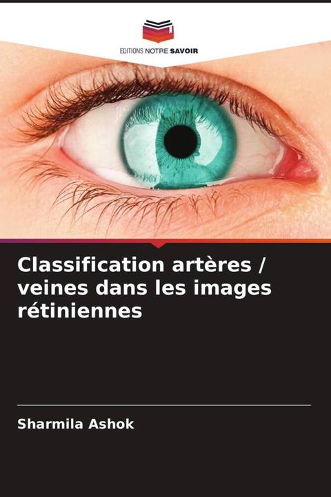 Actual product image Classification artères / veines dans les images rétiniennes (German, Sharmila Ashok, 2022)