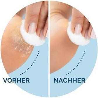 Immagine prodotto Scholl Extra strong (2 x)