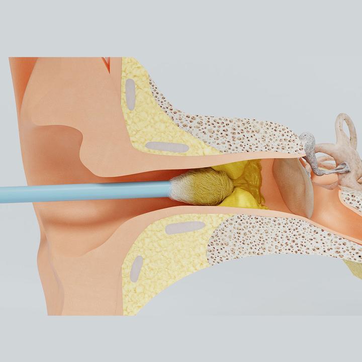 Image du produit ReUseMe Outil de nettoyage de l'oreille