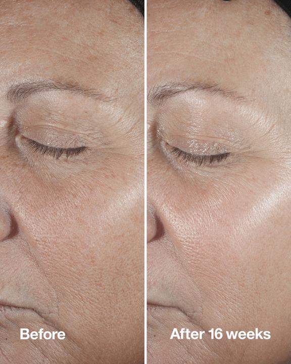 Actual product image Clinique Smart Custom-Repair Serum (50 ml)