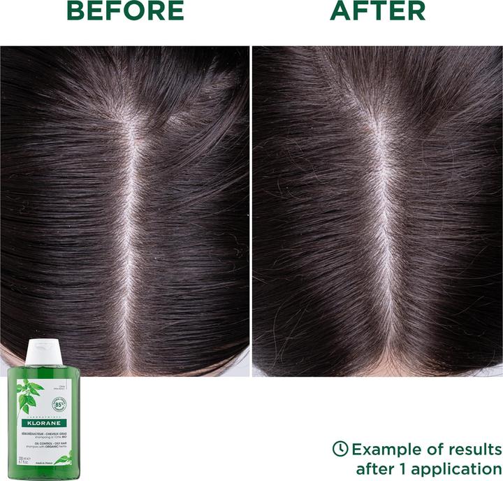 Produktbild Klorane Talgregulierendes Shampoo mit BIO-Brennnessel (400 ml, Flüssiges Shampoo)