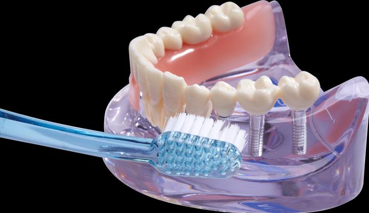 Actual product image Vitis implant Sulcus toothbrush Toothbrush (1 x)