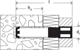 Produktbild Fischer Sanieranker 180 mm 532883 5 St. (532883) (5 Stk.)