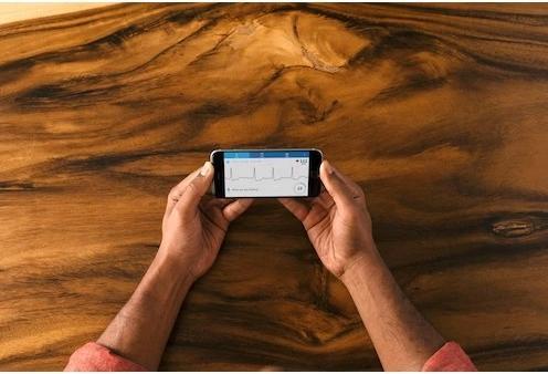 Actual product image AliveCor Ekg device Al-Kardiamobile