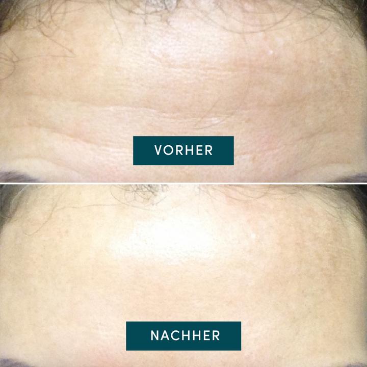 Immagine prodotto Apricot wiederverwendbares Stirn Pad Aloe Vera "aloe you ready?"