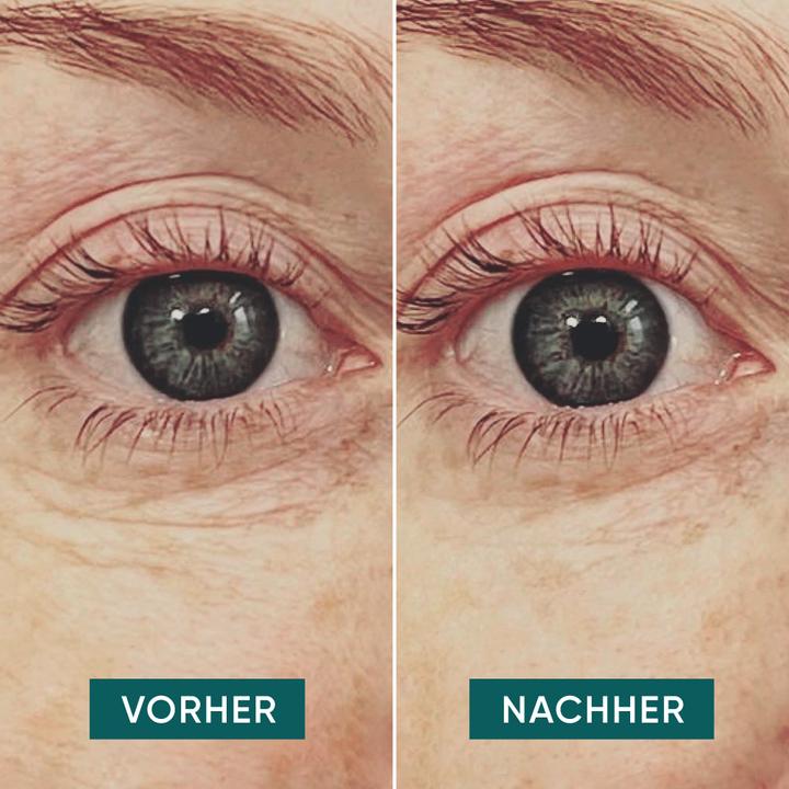 Image du produit Apricot Pads réutilisables pour les yeux à la vitamine C "glow getter". (Patchs)