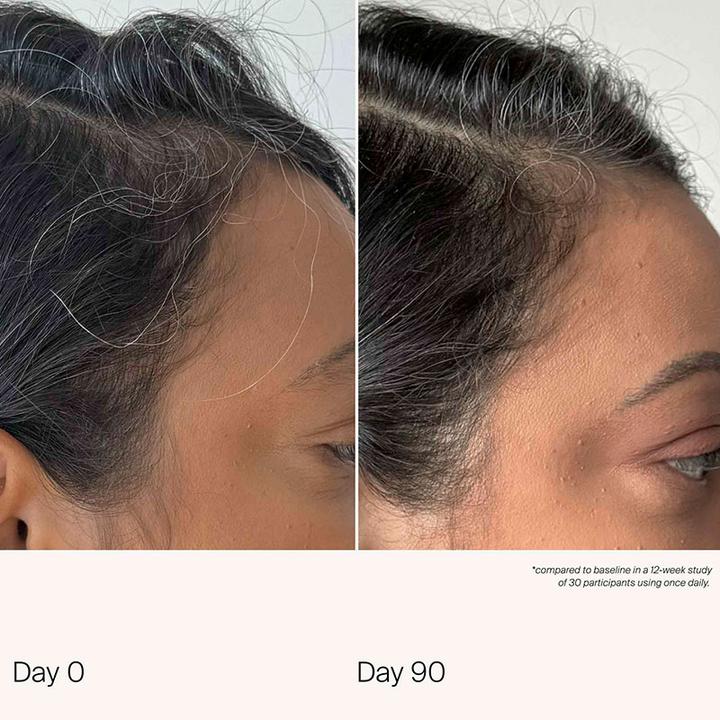 Image du produit Living Proof Scalp Care Density Serum 1.7 Fl Oz (50 ml)