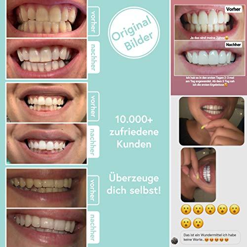 Produktbild UniqueSmile Teeth Whitening Kit