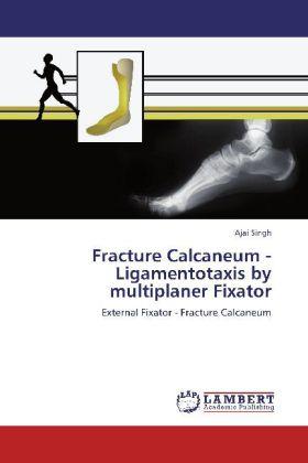 Produktbild Fracture Calcaneum - Ligamentotaxis by multiplaner Fixator (Ajai Singh, 2012)