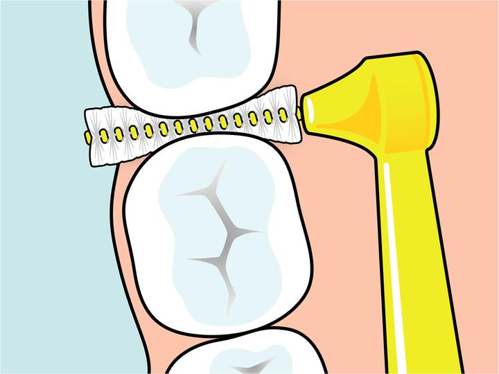 Actual product image TePe Angle ISO 1 interdental brushes (6 x, 0.45 mm)