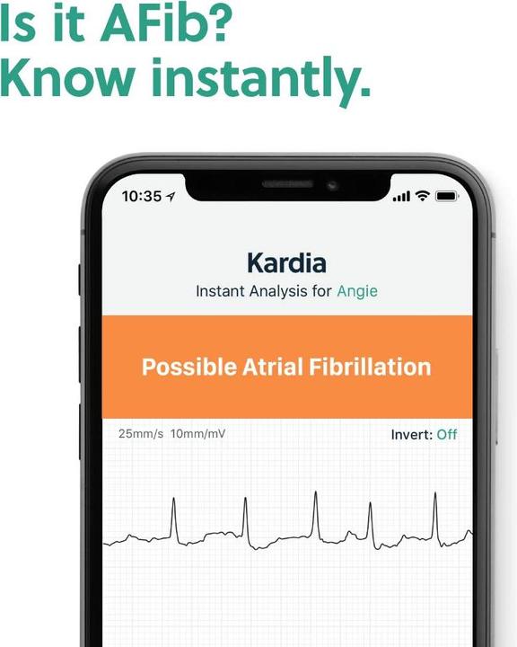 Produktbild AliveCor Kardiamobile 6L