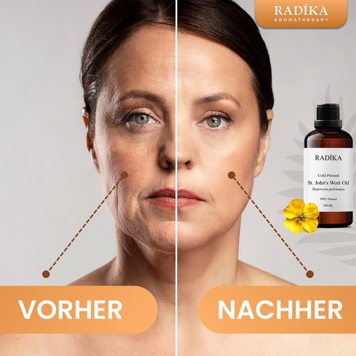 Produktbild Radika Johanniskrautöl, Johanniskrautöl, 100 % Rein, BIO, natürlich, 100 ml (Körperöl, 100 ml)