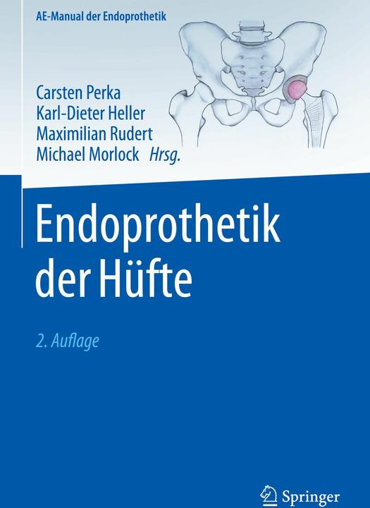 Produktbild Endoprothetik der Hüfte (Deutsch, Carsten Perka, Maximilian Rudert, Karl-Dieter Heller, Michael M. Morlock, 2024)