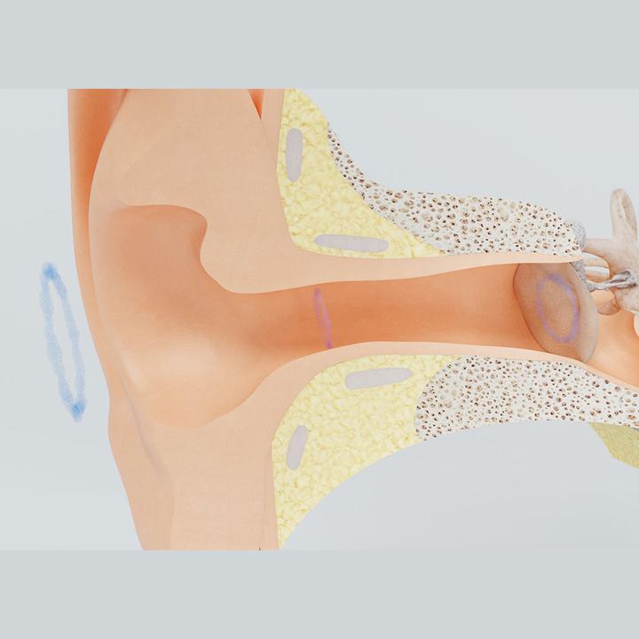 Image du produit ReUseMe Outil de nettoyage de l'oreille