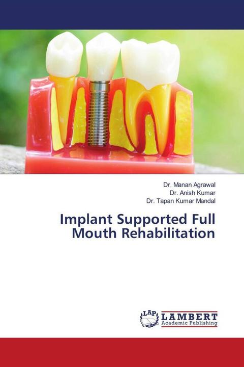 Produktbild Implant Supported Full Mouth Rehabilitation (Dr. Anish Kumar, Dr. Manan Agrawal, Dr. Tapan Kumar Mandal, 2021)