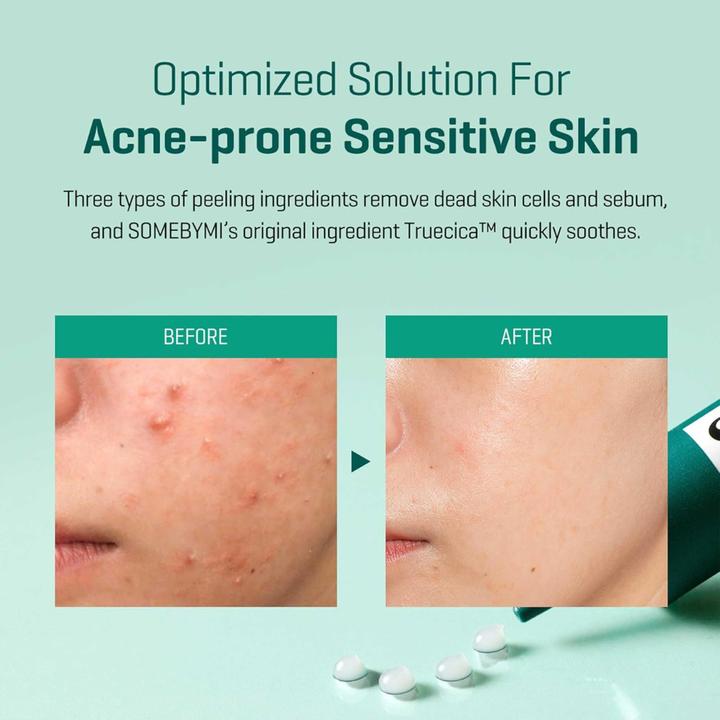 Actual product image Some By Mi AHA.BHA.PHA 4Days Super Miracle Spot All Kill Cream (30 ml, 24h cream)