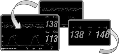 Immagine prodotto Edan F2 Monitor fetale gemellare