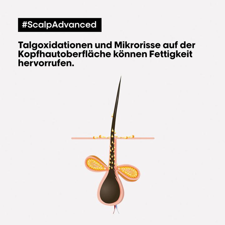 Immagine prodotto L'Oréal Professionnel Scalp Advanced (250 ml)