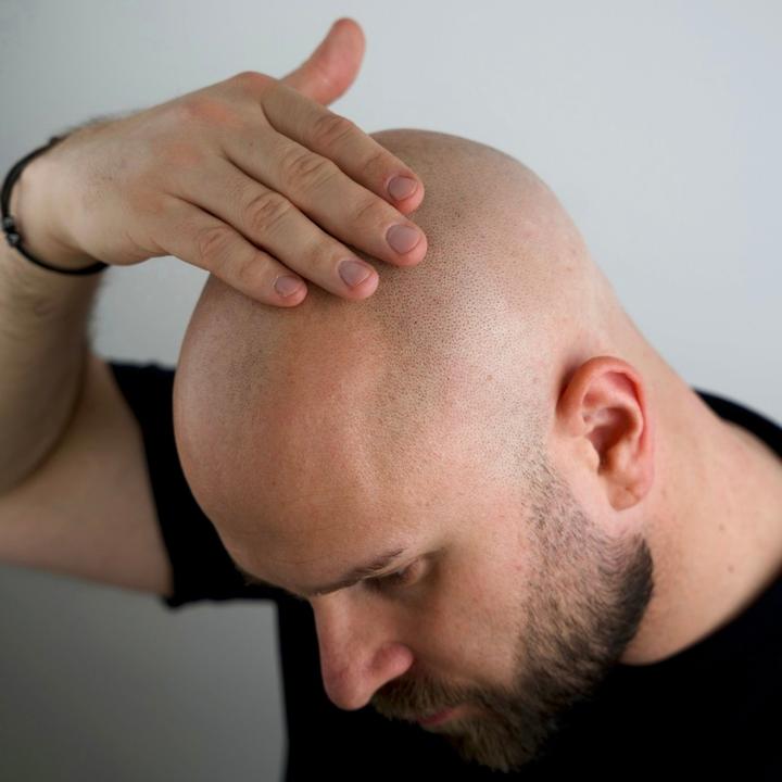 Actual product image Better be bold Bartöl und Glatzenöl - Bald Head & Beard Oil with Diamond Shine-Effect
