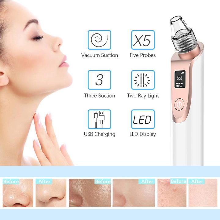 Produktbild Anlan X7 Mitesserentferner