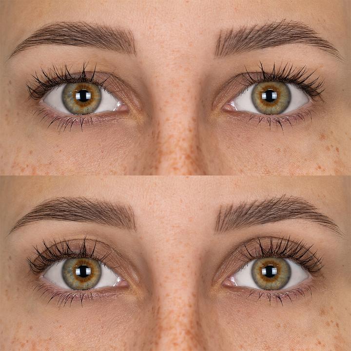 Actual product image Fleeky Magic Stripes stickers against drooping eyelids
