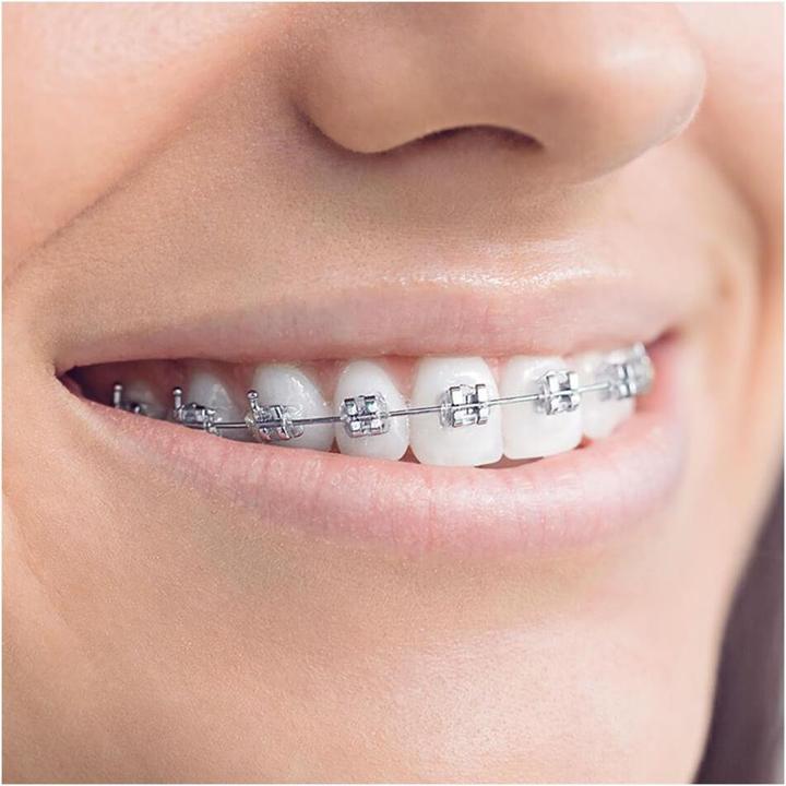 Actual product image Oral-B Teen (Oscillating toothbrush)