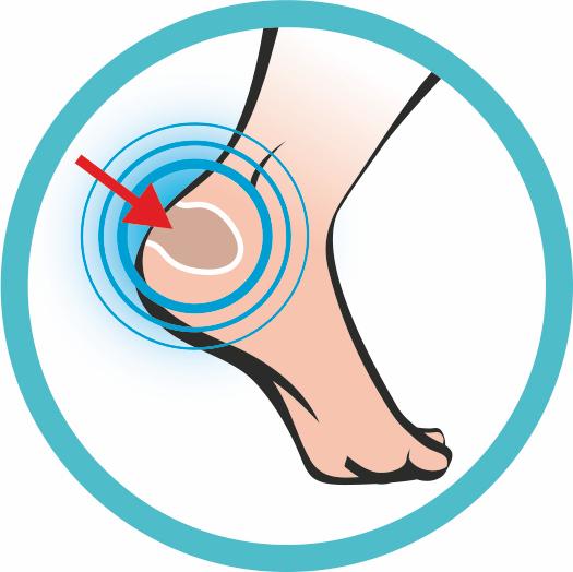 Actual product image Sidas Foot Protector 5x (5 x)