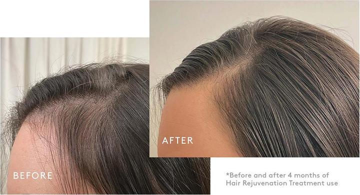 Immagine prodotto Virtue Labs Trattamento di ringiovanimento dei capelli Flourish (Set per la cura dei capelli)