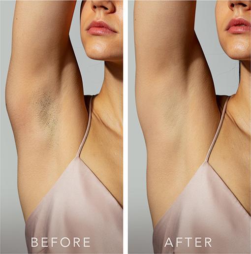 Produktbild Foreo Peach 2