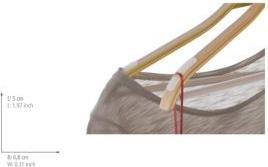 Actual product image Wenko Anti-slip strips (20 x)