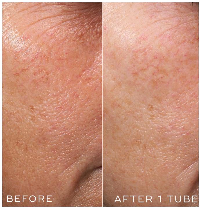 Produktbild Medik8 Crystal Retinal (30 ml)