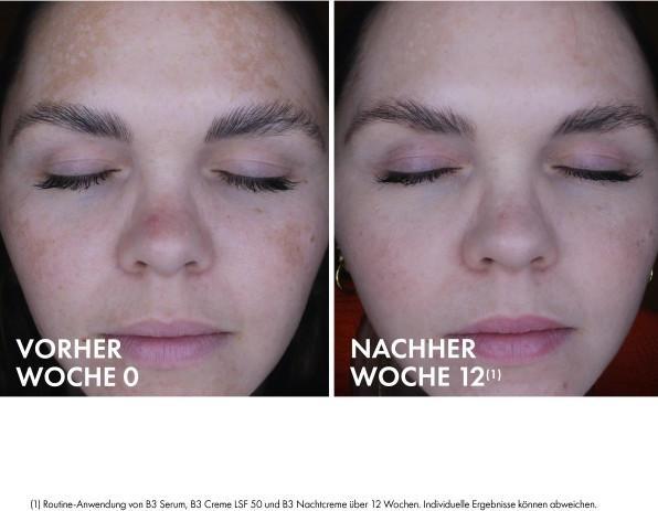 Actual product image Vichy Liftactiv B3 Retinol Night Cream (50 ml, Night cream)