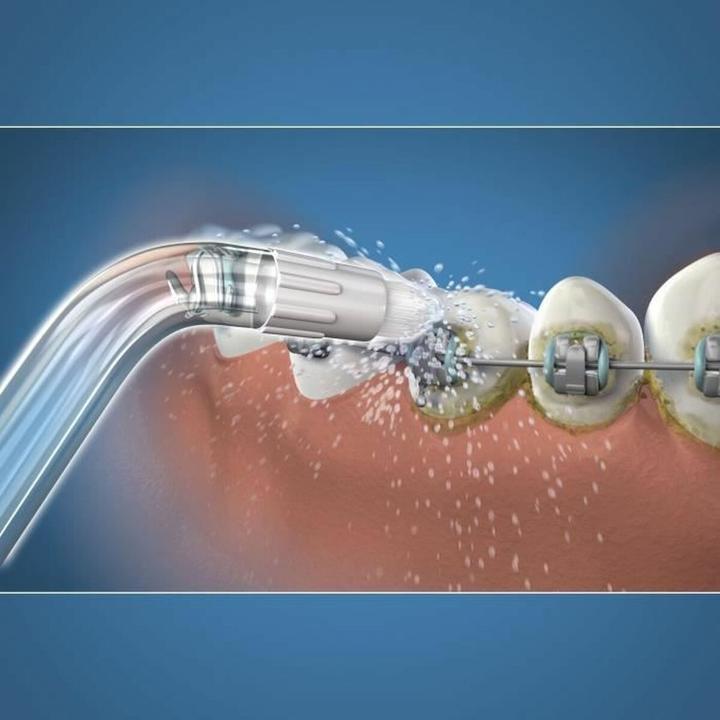 Image du produit Waterpik Orthodontie (Embouts de douches buccales)