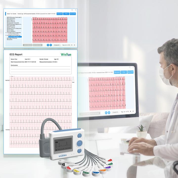 Actual product image ViatomTech TH12 Wearable 12-Lead holter with AI analysis