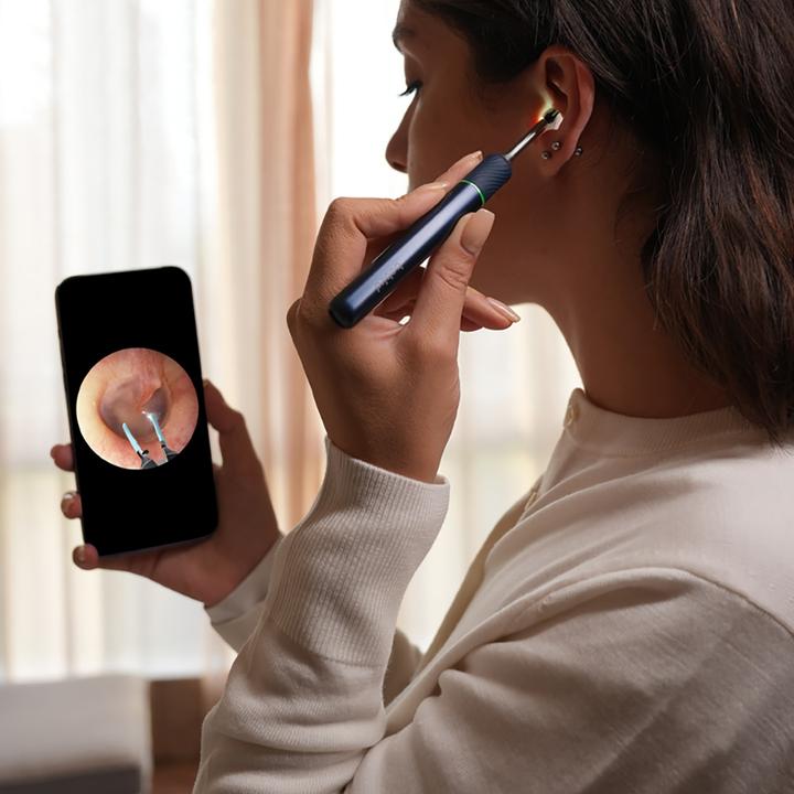 Actual product image Bebird Ear cleaner