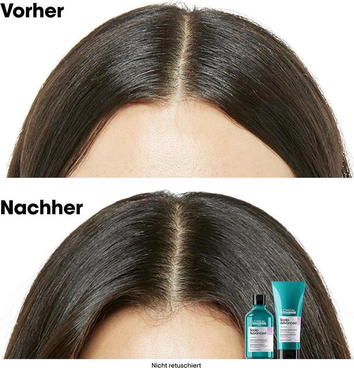 Immagine prodotto L'Oréal Professionnel Serie Expert Duo Coffret (Set per la cura dei capelli)