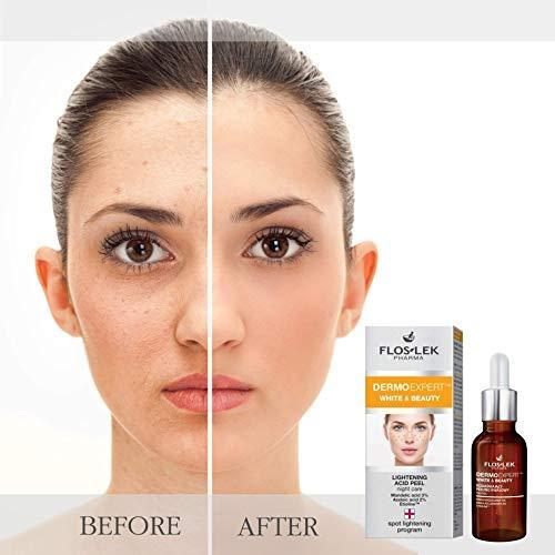 Image du produit Floslek facial scrub Pharma Dermo Expert White & Beauty whitening 30 ml (30 ml)