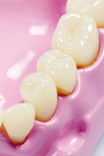 Actual product image Betzold Masticatory and dental model