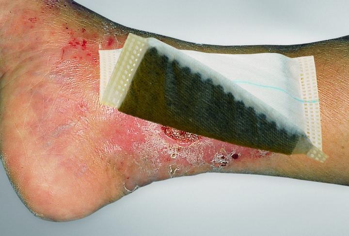 Vliwaktiv Ag Aktivkohle Verband steril
