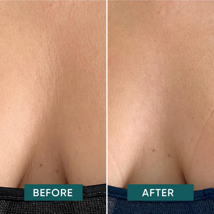 Immagine prodotto Apricot wiederv Dekol Pad una calma di distanza (Crema corpo, 42.04 ml)