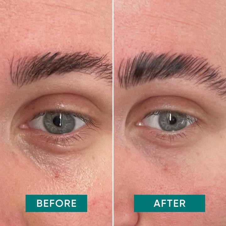 Image du produit Apricot Pads réutilisables pour les yeux à la vitamine C "glow getter". (Patchs)