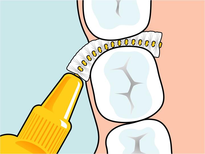 Produktbild TePe Original (8 x, 0.45 mm)