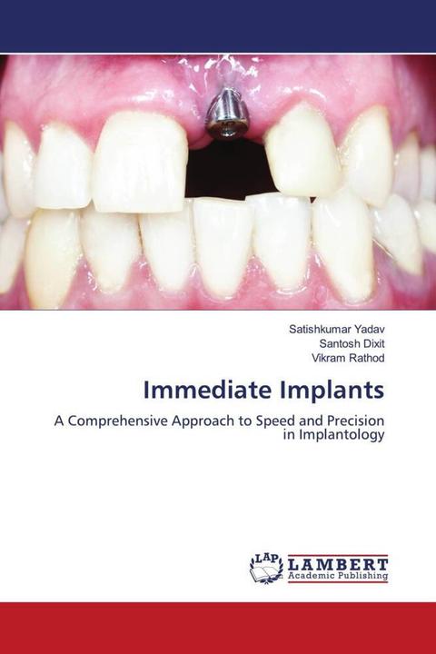 Produktbild Immediate Implants (Deutsch, Santosh Dixit, Vikram Rathod, Satishkumar Yadav, 2024)