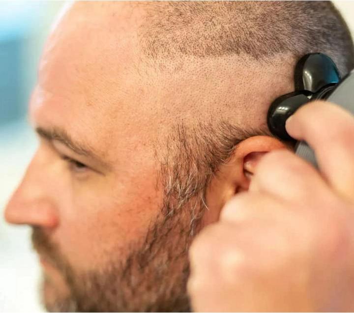 Actual product image Novidarte Bald shaver 5-in-1