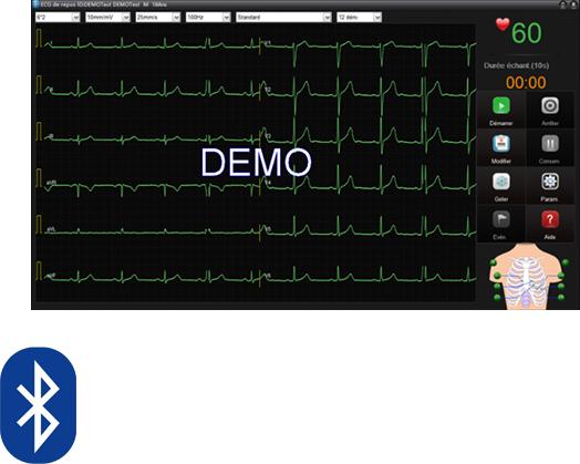 Image du produit Edan ECG de repos SE-1515 DX12 (Bluetooth)
