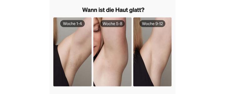 Actual product image Ulike Air 3 PUR