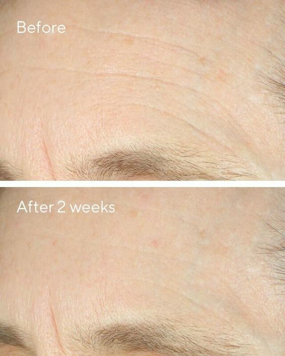Actual product image Murad 15293 Day / Night Cream Women All ages 50 ml (50 ml)
