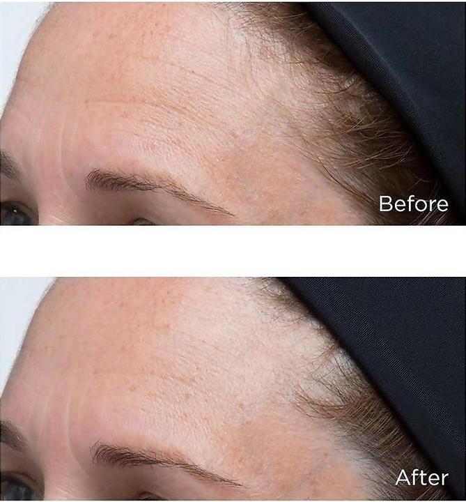 Actual product image Perricone MD High Potency Classics Hyaluronic Intensive Moisturizing Face Cream Women Gel 30 ml (30 ml, Day cream, Face gel)
