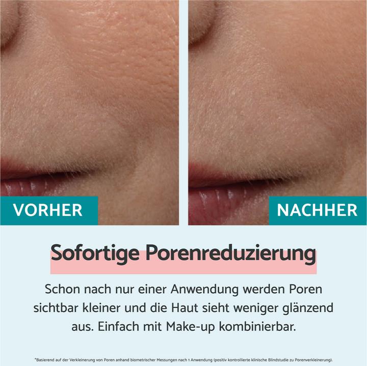 Actual product image Remescar Immediate pore reduction (20ml) (20 ml, Day cream)